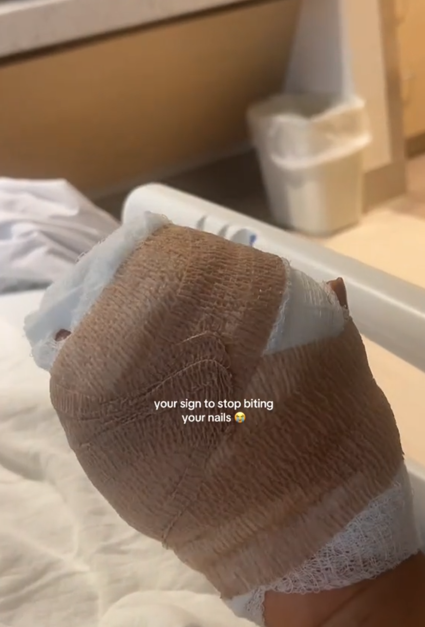 Bandaged hand of woman in hospital